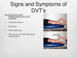Dvt