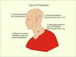 Types Of Headaches Frontal Headache Headache Types Headache Location