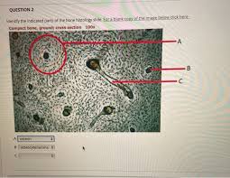 The central haversian canal, and horizontal canals (perforating/ volkmann's) canals contain blood vessels and nerves from the periosteum. Solved Question 2 Identify The Indicated Parts Of The Bon Chegg Com