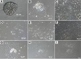 Check spelling or type a new query. Scielo Brasil Primary Cultures Of Mouse Small Intestinal Epithelial Cells Using The Dissociating Enzyme Type I Collagenase And Hyaluronidase Primary Cultures Of Mouse Small Intestinal Epithelial Cells Using The Dissociating