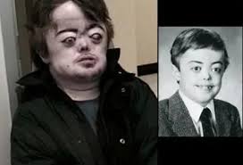 Brian Peppers. A person who was given an unfair hand in life. : r/Weird