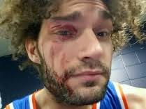 Робин Лопес, центровой Милуоки Бакс — последние новости, статистика,  интервью, фото