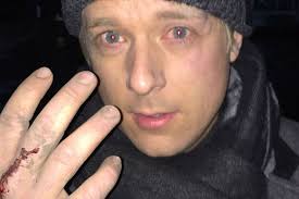 G4 singers attacked by mugger