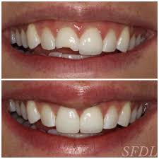 Pin On Emergency Dentist Posts