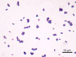The coccus portion of the name refers to the bacteria's spherical shape. Coccus Wikipedia
