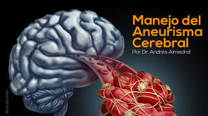 Aneurisma cerebral las altas presiones arteriales y las pulsaciones. Manejo Del Aneurisma Cerebral