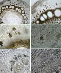 We did not find results for: Occurrence Types And Distribution Of Calcium Oxalate Crystals In Leaves And Stems Of Some Species Of Poisonous Plants Botanical Studies Full Text