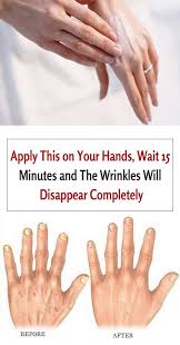 9 Amazing Home Remedies For Wrinkle Free Hands With Images Home Remedies For Wrinkles Beauty Care Wrinkles Hands