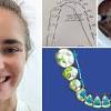 Clear aligners are more expensive than metal dental braces, but its cost is almost the same as ceramic dental braces and lower than that of lingual braces, which are the alternatives. 1