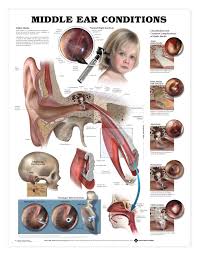 middle ear conditions such as pressure or infection which