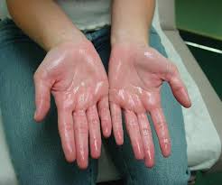 Doctors at riley at iu health use the following tests to diagnose periodic fever syndrome: Hyperhidrosis Wikipedia