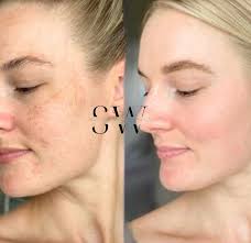 Paige Parent (@skinworksmedspa_) • Instagram photos and videos