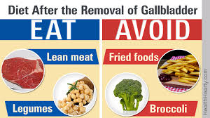 Gallbladder Is Removed In The Case Of Inflammation Or Developed Abnormalities The Common Treatment O Galbladder Diet Gallbladder Removal Diet Gallbladder Diet