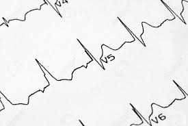 A Macro Picture Of The Ekg Chart