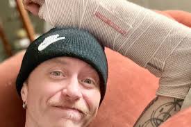 Fundraiser by Nathan Skeie : Post Wrist Injury: Needing Help