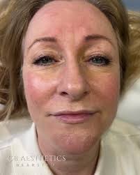 Profile for CB Aesthetics Bearsted