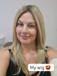 I'm fighting cancer and have lost all my hair. Although I've got hats and a  wig, I'm choosing not to wear them