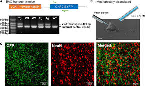 The warm colors of the flames contrasting beautifully with the cold pop of blue or green. Frontiers Amitriptyline Decreases Gabaergic Transmission In Basal Forebrain Neurons Using An Optogenetic Model Of Aging Frontiers In Aging Neuroscience