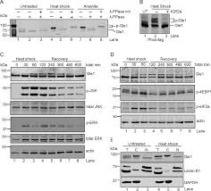 Maybe you have knowledge that, people have look numerous times for their chosen readings. Mapk And Glycogen Synthase Kinase 3 Mediated Phosphorylation Regulates The Dead Box Protein Modulator Gle1 For Control Of Stress Granule Dynamics Journal Of Biological Chemistry