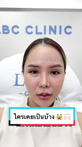ความงาม: ประสบการณ์การรีวิว Juvelook และ LBC Clinic