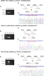 Identification Of Novel Brca1 Large Genomic Rearrangements