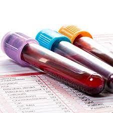 Let's take a closer look at tests for adults to have done regularly. Universal Cancer Blood Test