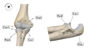 Image result for Coronoid Process Fracture