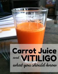 Vitiligo Definition And What Causes Vitiligo Vitiligo Treatment Vitiligo Cure Carrot Juice