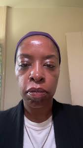 Trying out 2 concealers