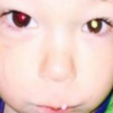 Cette photo a sauvé la vie de ce petit Américain de deux ans