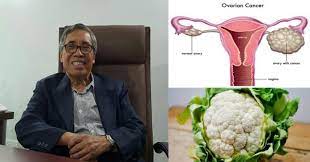 Cyst terbentuk disebabkan oleh terlalu banyak estrogen dan tak seimbang. Dr Hamid Arshad Kongsi Petua Berkesan Kecutkan Cyst Fibroid Pada Rahim Wanita Secara Semulajadi Kartel Dakwah