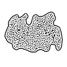 Conjoined twins occur once every 200,000 live births, according to the university of minnesota. Conjoined Twin Myslexia Demo Cover S I S S Y