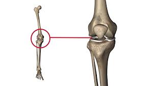 Image result for Thessaly Test