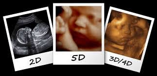 Ikat cincin perkahwinan anda dan gantung di atas perut. Ketahui 10 Manfaat Si Ibu Hamil Scan Imbasan Ultrasound Kandungan Di Klinik Ia Bagus Untuk Kandungan Bidadari My