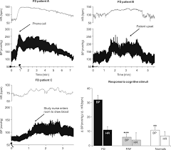 For this reason, they have trouble feeling pain, temperature, skin pressure and the position of their arms and legs. Familial Dysautonomia Riley Day Syndrome Sciencedirect