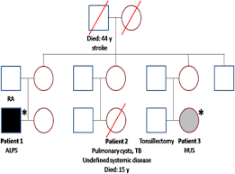 Pneumonitis is a general term for inflammation of lung tissue. Esid 2014 Oral Presentations Springerlink