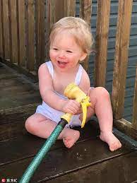 Unusual But True Baby Allergic To Water Including Own Tears World Chinadaily Com Cn
