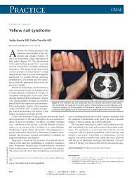 Image result for Yellow nail syndrome feet