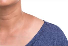 We did not find results for: Black Neck 7 Home Remedies Medical Treatment Self Care