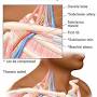 Thoracic outlet syndrome pain pattern from my.clevelandclinic.org