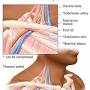 Vascular TOS from my.clevelandclinic.org