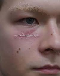 18 top White Ink Tattoo ideas in 2024