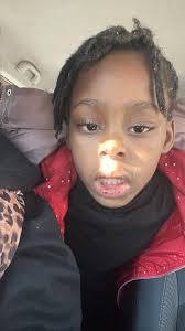 Impetigo treatment and remedies