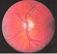 Behcet S Disease Wikipedia