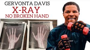 Gervonta tank davis has made a name for himself thanks to his prodigious power. Gervonta Davis Hand Not Broken Next Fight June 2021 Youtube