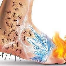 Fibromyalgie oder fibromyalgiesyndrom (von lateinisch fibra ‚faser', und von „myalgie, das ist muskelschmerz, von altgriechisch μῦς. Sechzehn Anzeichen Und Symptome Der Fibromyalgie Mehr Wichtig Nicht Zu Ignorieren Health Is Fitn Fibromyalgia Fibromyalgia Symptoms Chronic Fatigue Syndrome