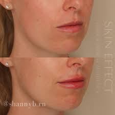 Shannon Begg BscN RN (@shannyb_rn) • Instagram photos and videos