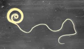 Image result for Whipworm