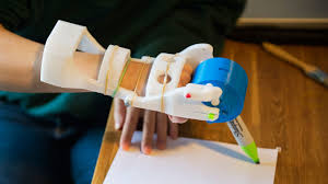 2100 x 1440 jpeg 1122 кб. These Amazing Prosthetic Hands Were Built By High School Students