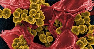 заеды в уголках рта причины и лечение у взрослых Lyamblioz Simptomy I Lechenie Novosti Gorodskie Novosti Krasnoyarsk